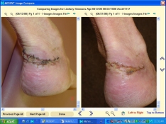 Comparing Images