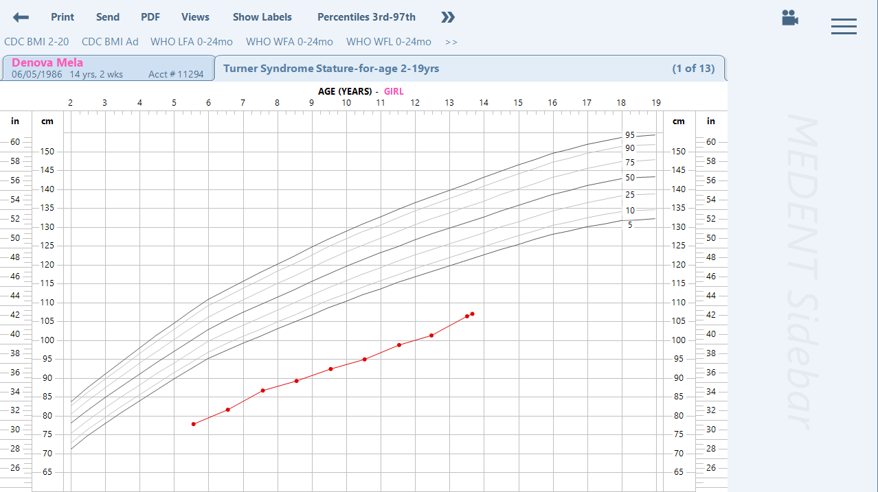 Turner Syndrome Growth Chart